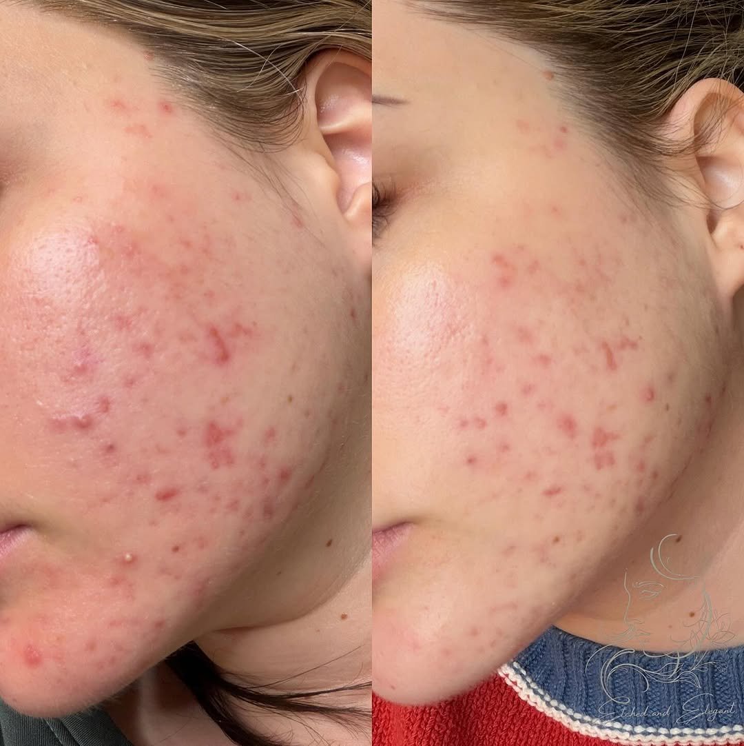 Photo by SARA | Cosmetic Tattoo Artist & Trainer on February 21, 2026. May be an image of text.