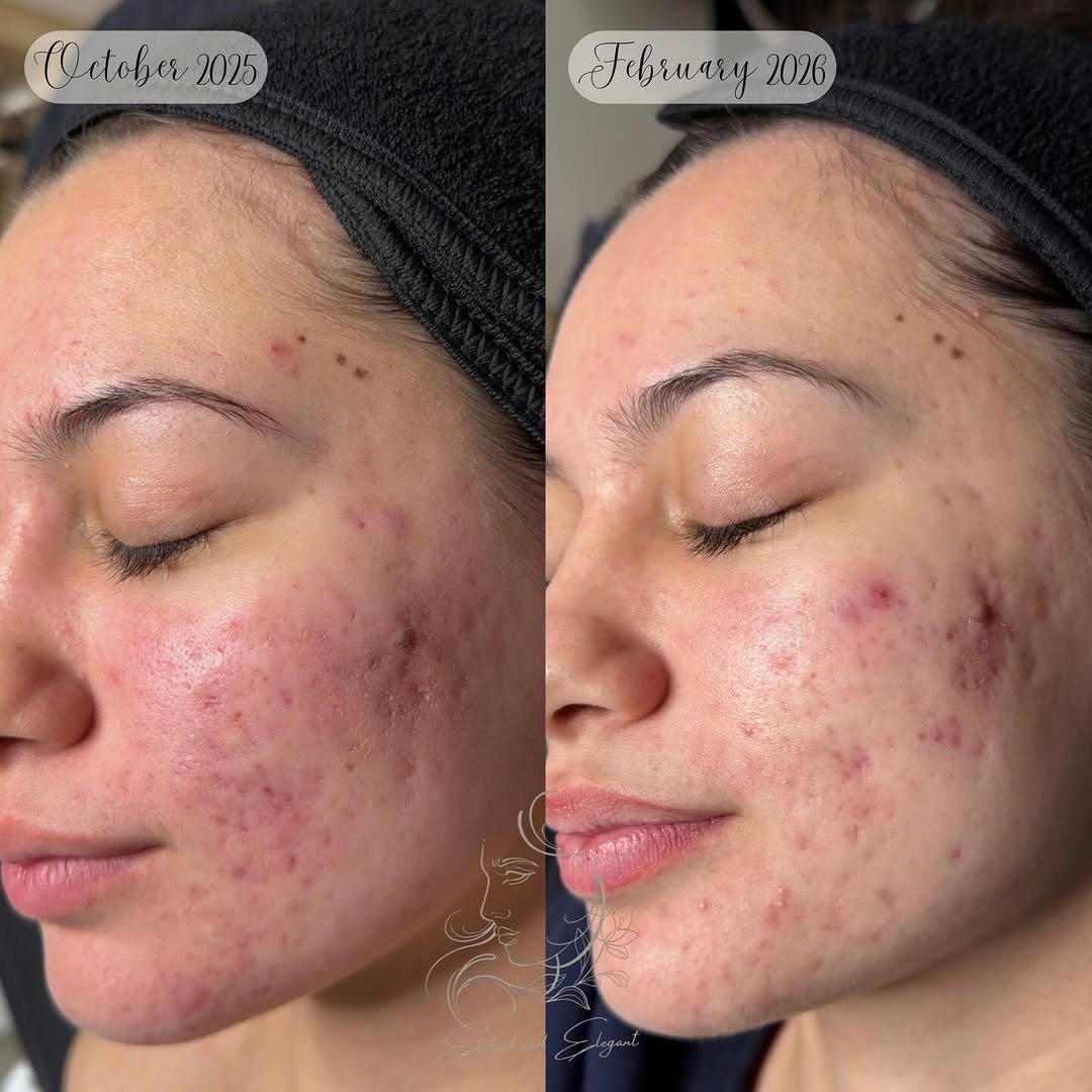 Photo by SARA | Cosmetic Tattoo Artist & Trainer on February 18, 2026. May be an image of text.