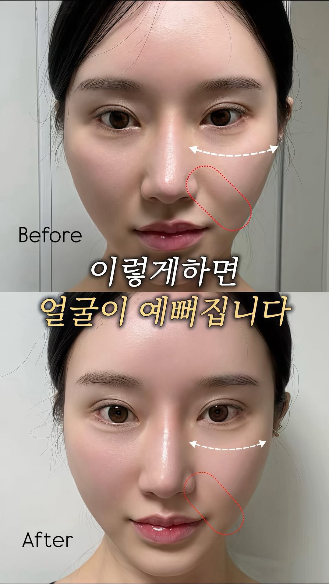 eternalskin__ 게시물 이미지: 매일 1분씩 “여기”만 잘 풀어줘도
리프팅 시술 없이 얼굴 라인이 달라진다는...