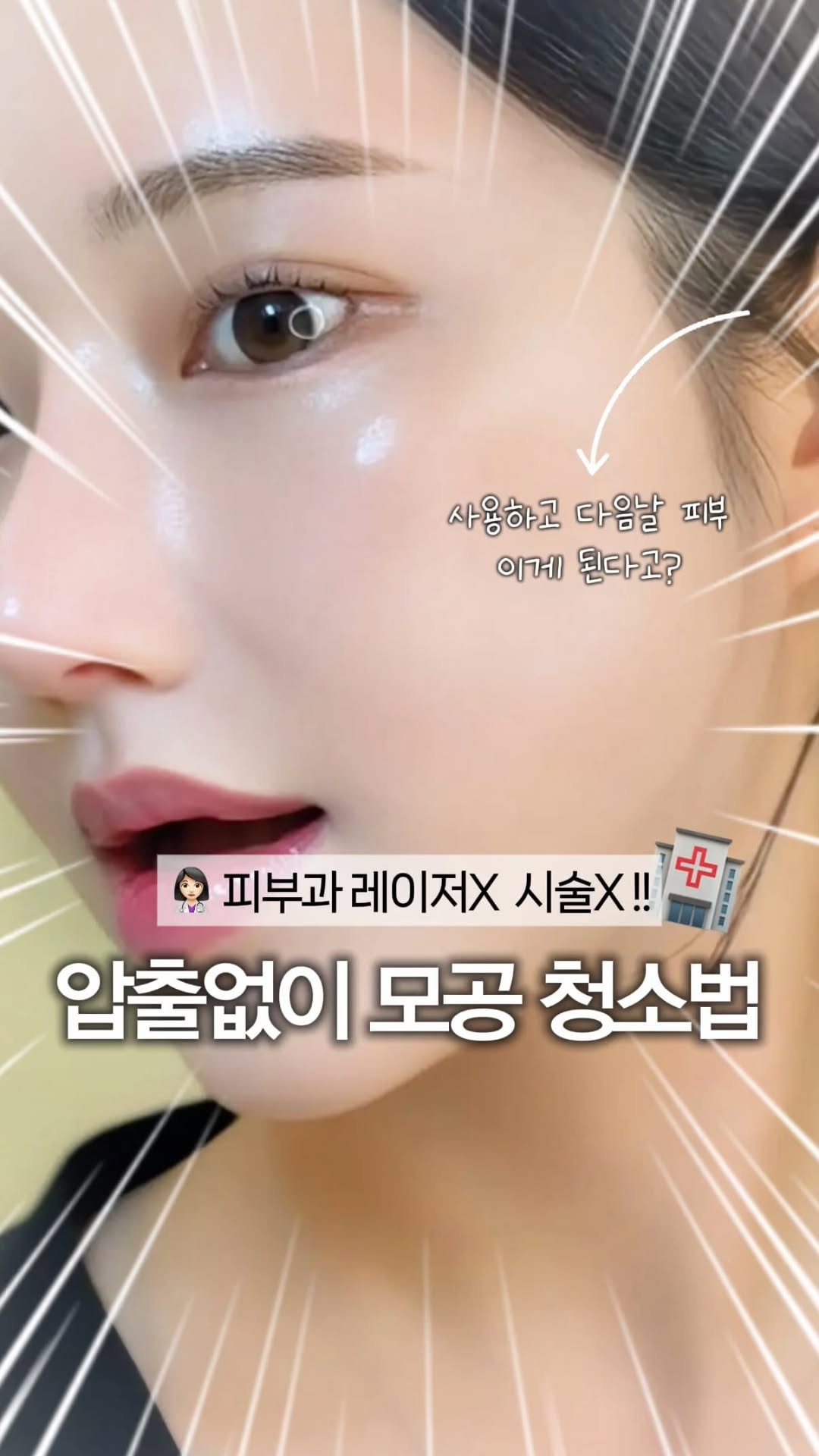 eternalskin__ 게시물 이미지: 이거 진짜 샵망할 각오하고 1회 20만원짜리 관리
집에서 만원대로 하는방법...