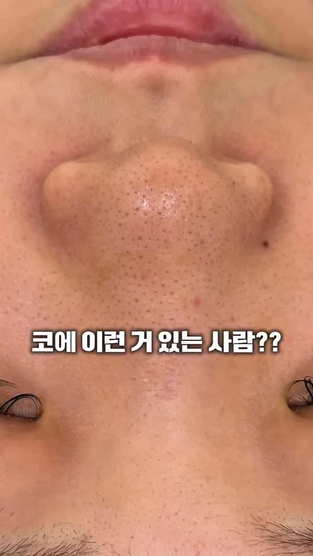 eternalskin__ 게시물 이미지: 진짜 피부샵 망할 각오 하고
집에서 1회 350원꼴로 관리 하는방법...