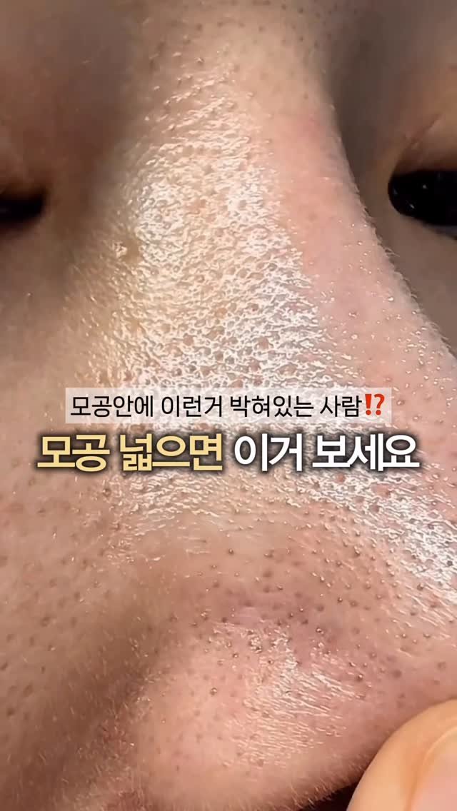 eternalskin__ 게시물 이미지: 클렌징 오일, 코팩 아무리 뜯고 뽑아도
효과 없는분들 이렇게 꼭 써보세요!

뽑고...