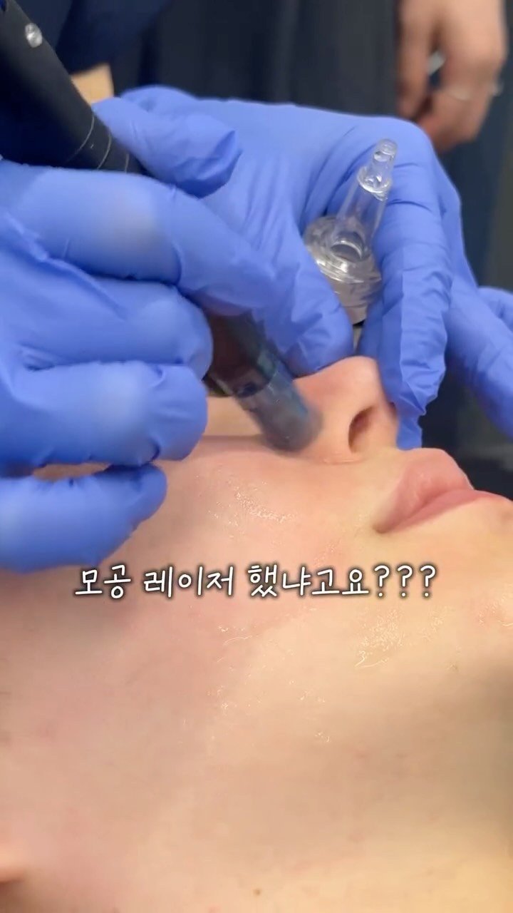 eternalskin__ 게시물 이미지: 피부과 갈 돈 굳히는 홈케어 끝판왕 🏠💉

✔ 늘어지는 모공이 고민일 때
✔ 피부...