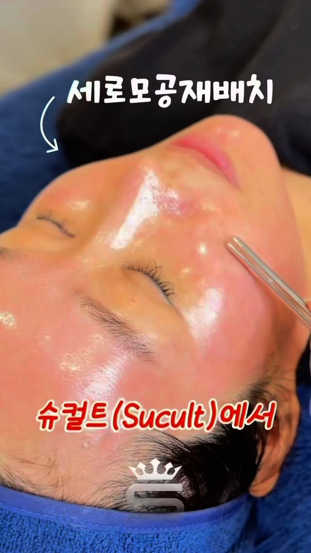eternalskin__ 게시물 이미지: ✨ 스킨케어의 판을 바꾸다, Sucult ✨
수천 건의 임상으로 증명된 슈퍼젝션의...