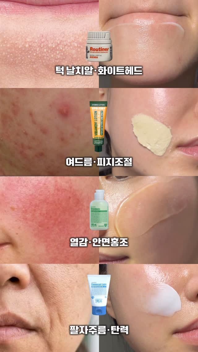 eternalskin__ 게시물 이미지: 여러분 지금 거울 봤을때 피부에서 가장 없애버리고
싶은 건 뭔가요? 🧐

고민되는...