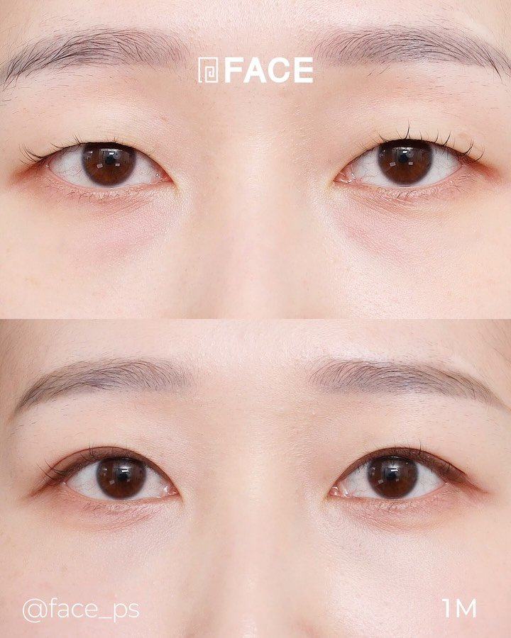 face_ps 게시물 이미지: 숨겨졌던 매력적인 눈빛을 같이 꺼내볼까요?
->...