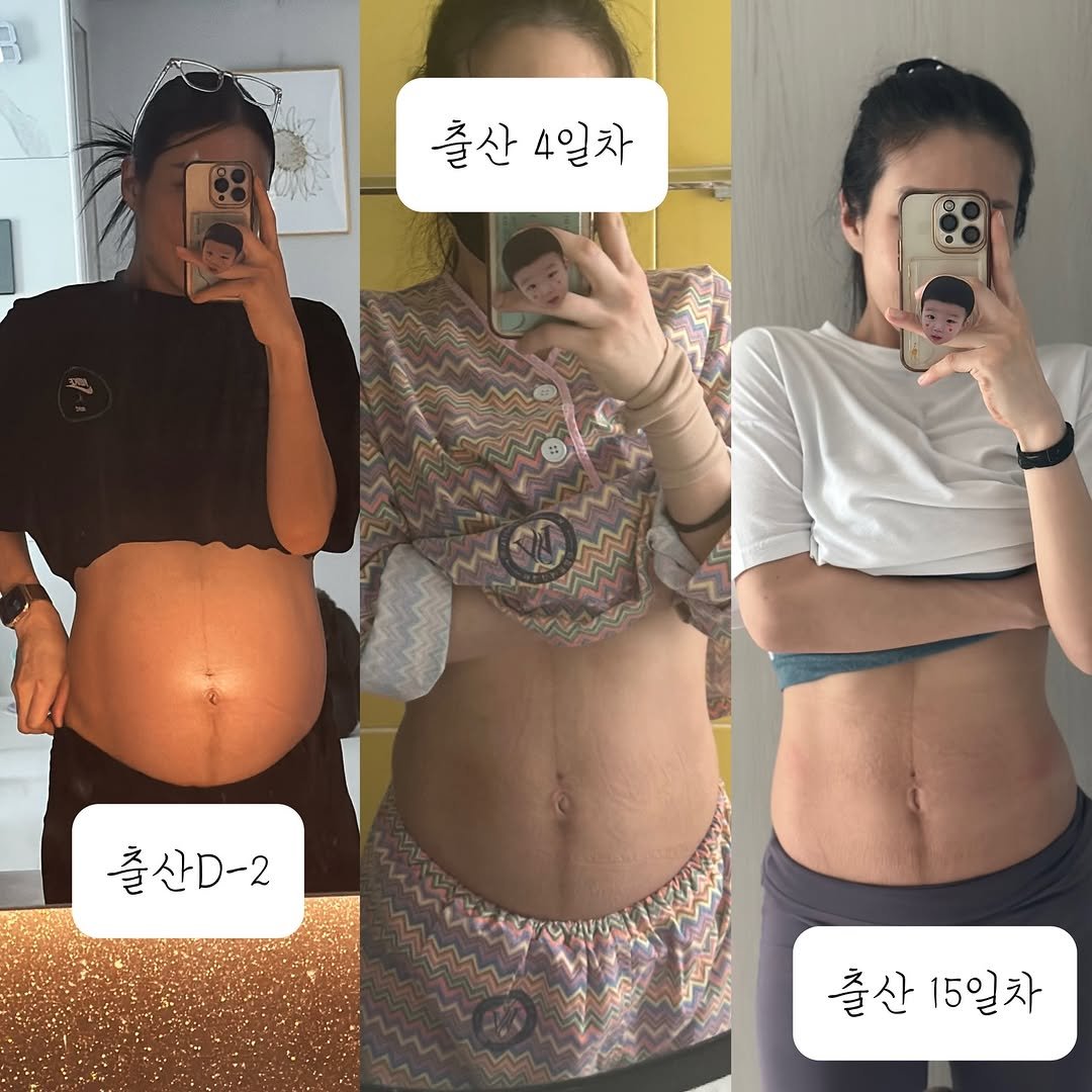 fit.jessy_0603 게시물 이미지: ✨정보공유✨
#제왕절개회복 #출산회복 #산후회복 #산후운동 #복직근이개
💚출산...