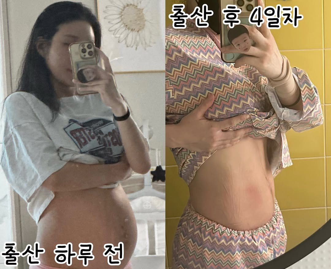 fit.jessy_0603 게시물 이미지: 긴글주의🙏#산후회복 #제왕절개회복 #출산기록 #임신기록 
출산 후 4일차...