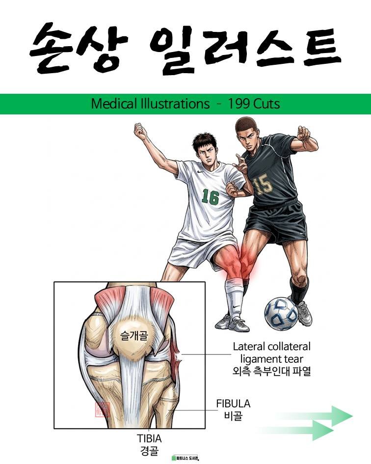 fitness_library_ 게시물 이미지: 손상 일러스트....
(앞서 메디컬 일러스트 199컷 구매자 분들은 공짜이니...