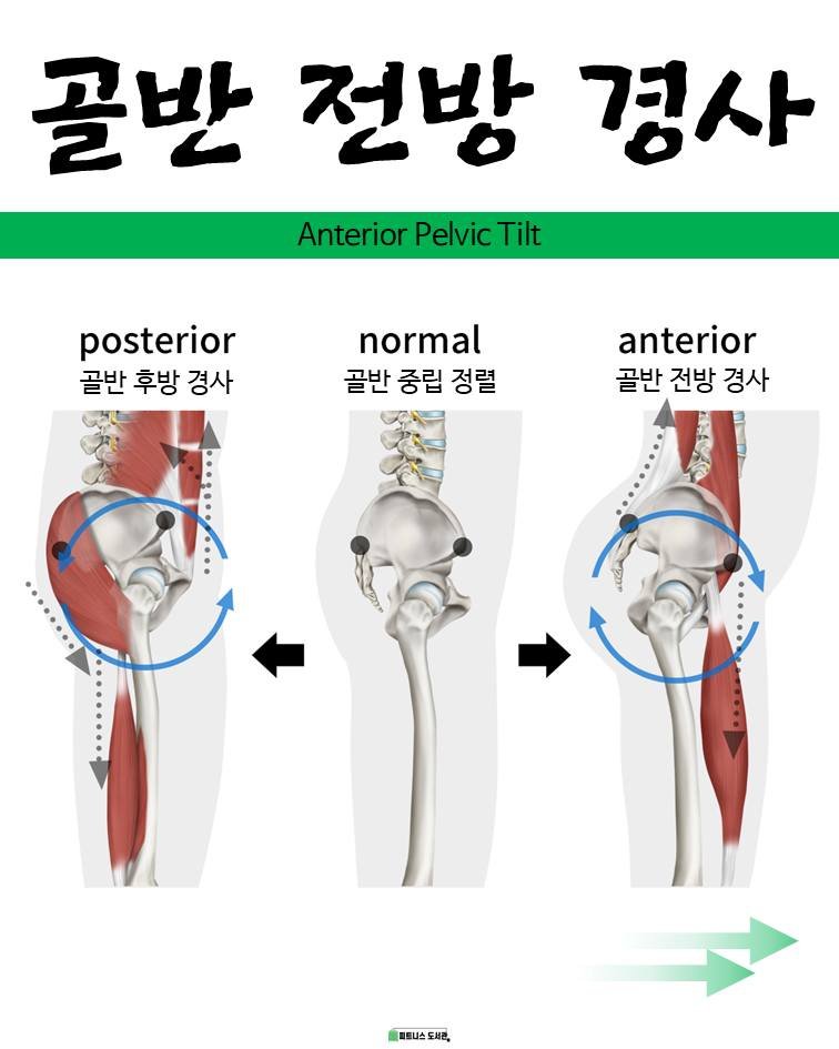 fitness_library_ 게시물 이미지: 골반 전방 경사는............. 

✅ 달력형 근막경선 도감 +...