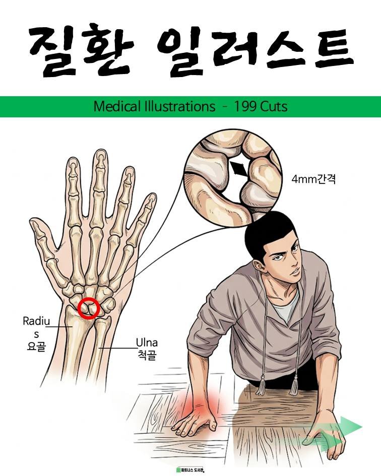 fitness_library_ 게시물 이미지: 질환 일러스트....
(앞서 메디컬 일러스트 199컷 구매자 분들은 공짜이니...