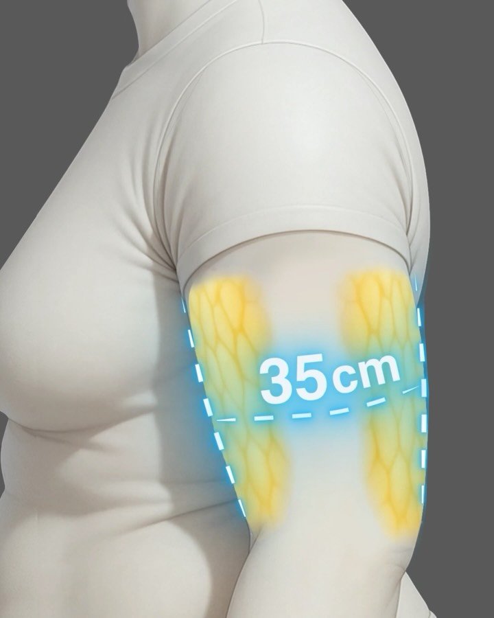 fitonomyapp 게시물 이미지: Flabby Arms? Do this 🔥

No gym. No equipment....