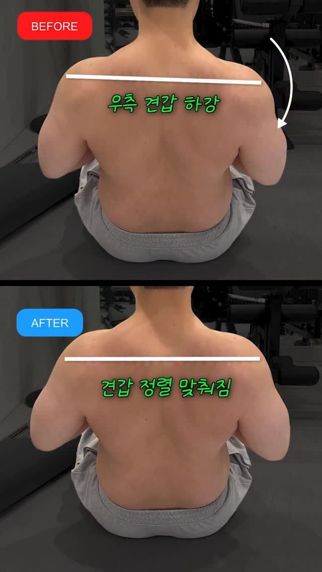 fixyrbody 게시물 이미지: ‘시티드 로우 시 삼두근 통증 케이스’

오늘 소개할 케이스는
시티드 로우에서...