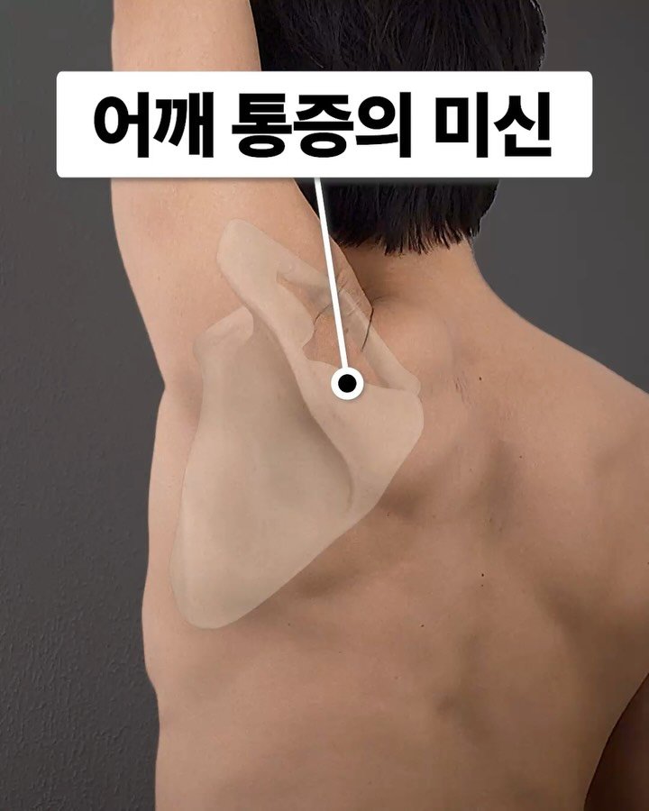 fixyrbody 게시물 이미지: ‘어깨위팔리듬에서 벗어나야 합니다!’

물리치료학과를 나왔다면
‘뉴만의...
