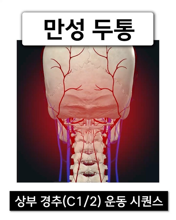 fixyrbody 게시물 이미지: ‘경추성 두통 4가지 운동 시퀀스’ 
두통을 유발하는 원인은 매우 다양하지만, 그중...