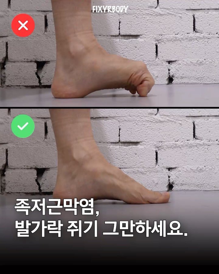fixyrbody 게시물 이미지: ‘족저근막염에 도움되는 숏 풋 운동’

안녕하세요 오늘은
족저근막염에 도움이...
