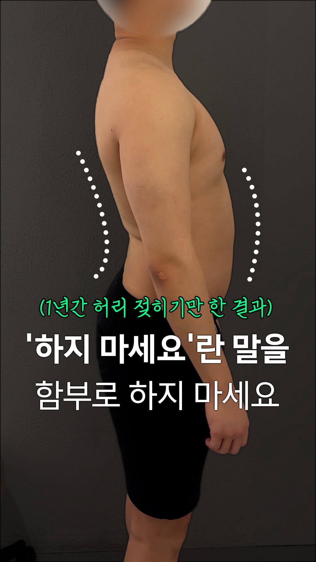 fixyrbody 게시물 이미지: ‘하지 마세요’ 란 말을
함부로 하지 마세요.

요즘 이런 환자분이 너무 많이...