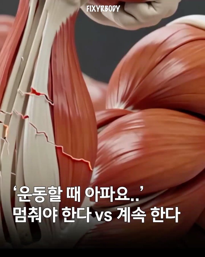 fixyrbody 게시물 이미지: ‘운동 통증, 어떻게 해야할까?’

안녕하세요 오늘은
운동 중 통증이 나타날...
