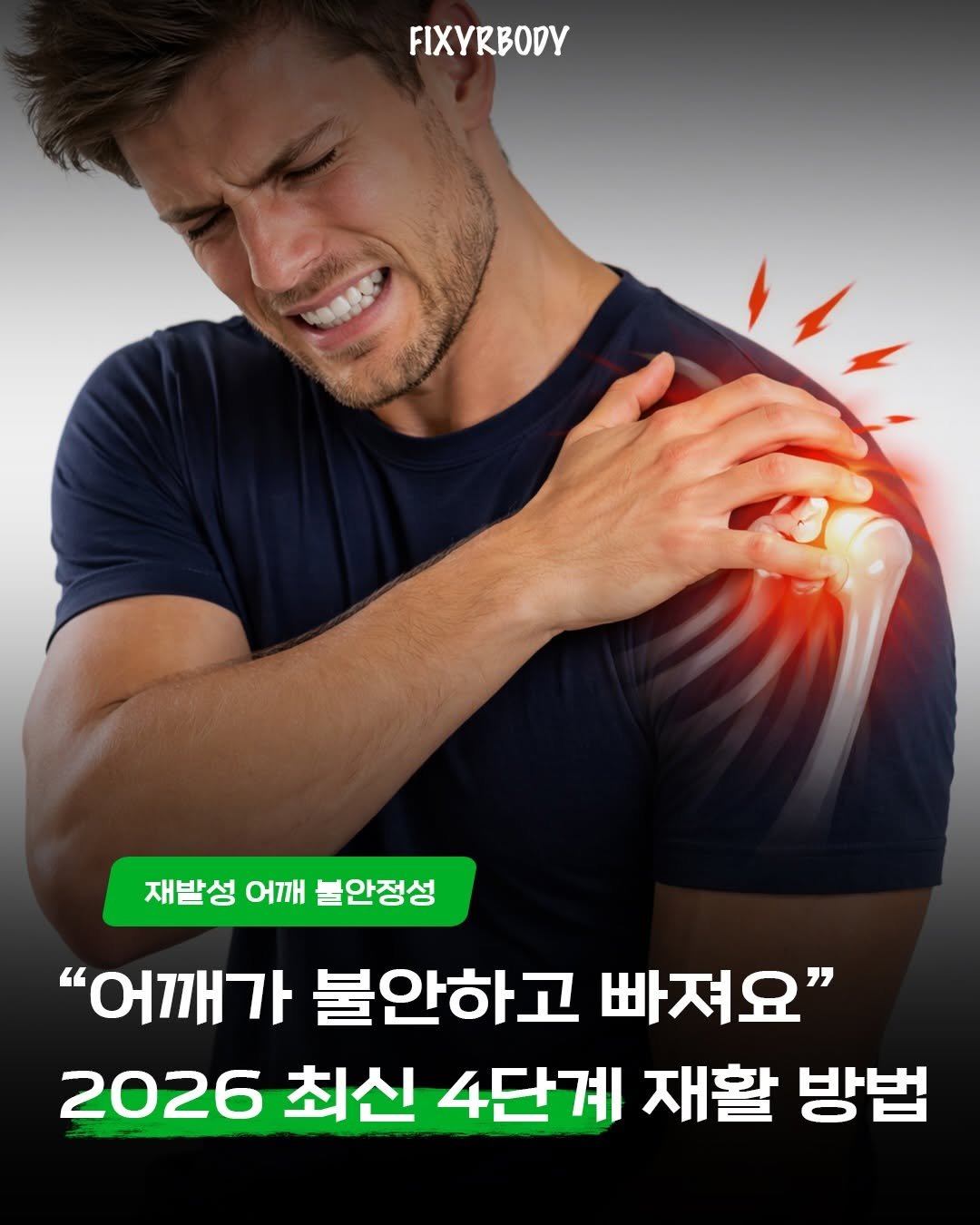 Photo by 물리치료사 우영석 on February 22, 2026. May be an image of medicine and text that says 'FIXYRBODY 재발성 어깨 불안정성 "어깨가 불안하고 빠져요" 2026 최신 4단계 재활 방법'.