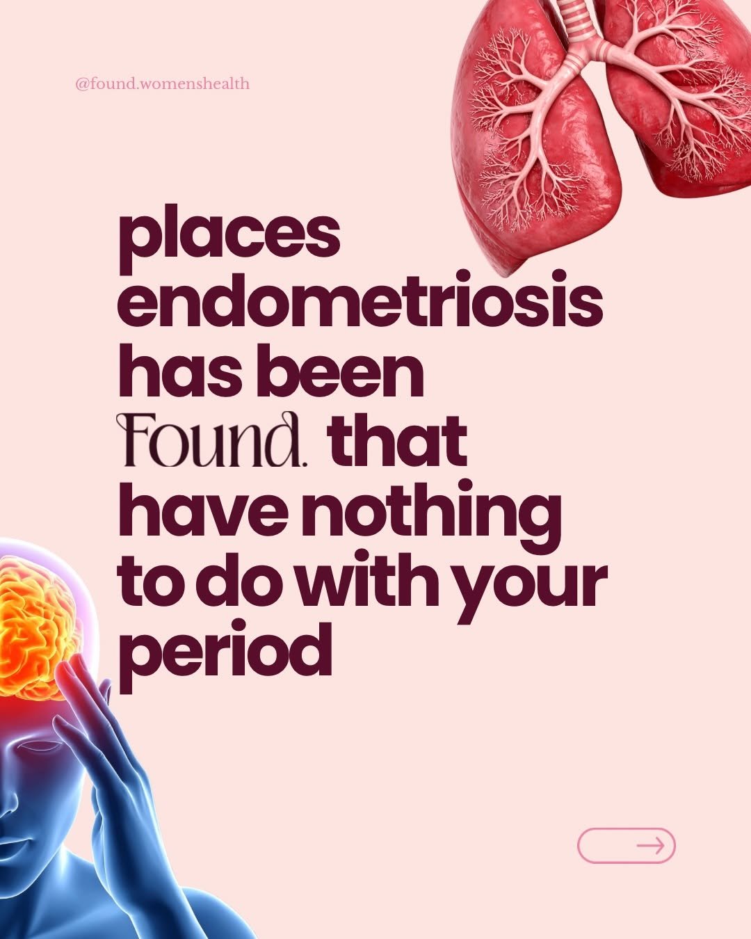 found.womenshealth 게시물 이미지: endometriosis has been found in the lungs, the...