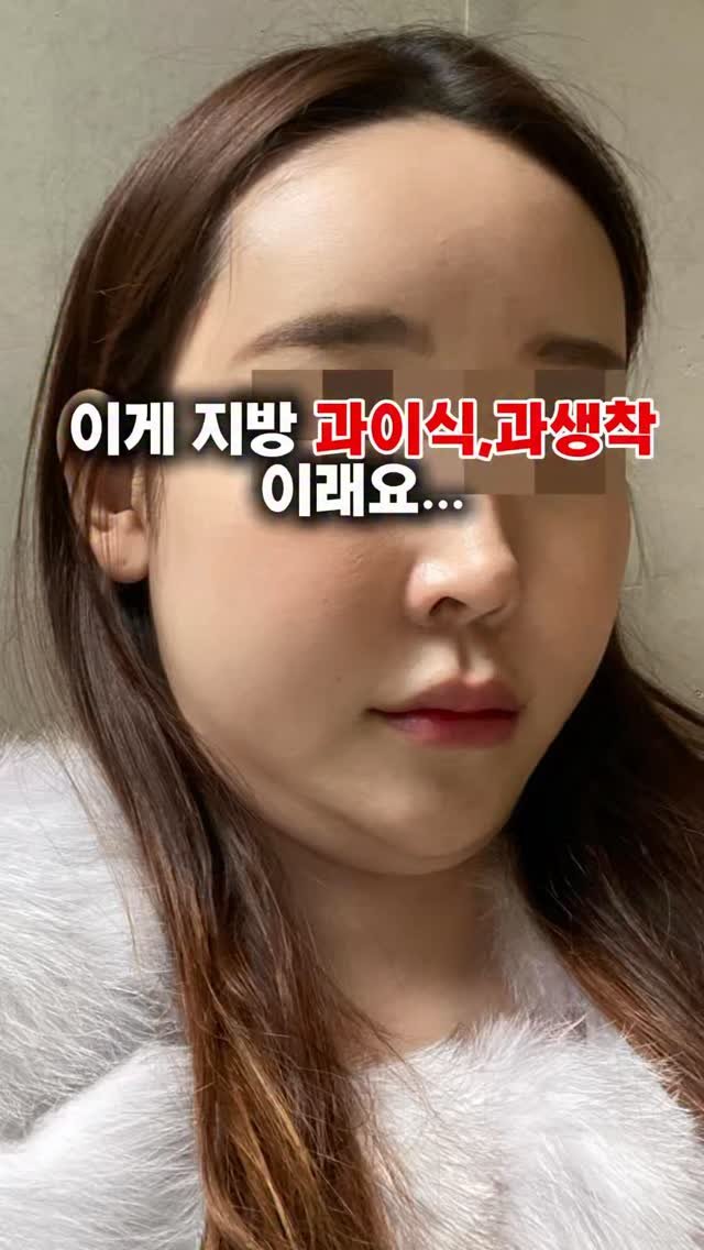 freshps_official 게시물 이미지: “지방이식 했는데 얼굴이 더 커 보이거나
울퉁불퉁해 보인다면요,

📌이건 단순...