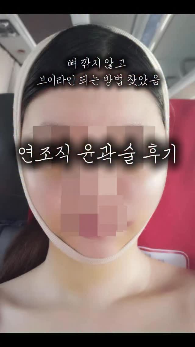 freshps_official 게시물 이미지: 뼈 안건드렸는데 V라인 되는 이유‼️

✅이거 모르고 다이어트만 하면
얼굴 절대...