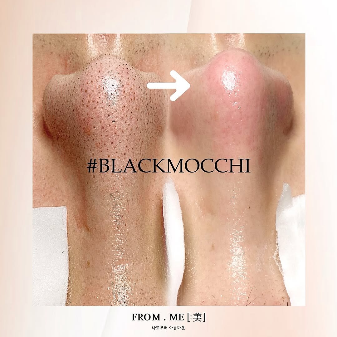 from.me_skin 게시물 이미지: 월 3000명 이상의 고객님들께서 방문하시는 프롬미.
고객님들께서는 주로 어떤...