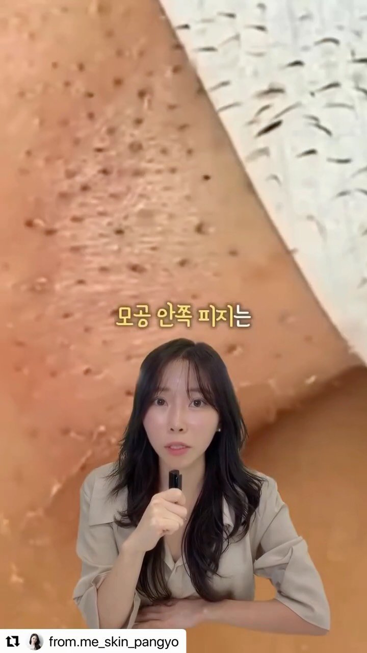 from.me_skin 게시물 이미지: #Repost @from.me_skin_pangyo 
・・・
코팩으로 블랙헤드 뽑힌...