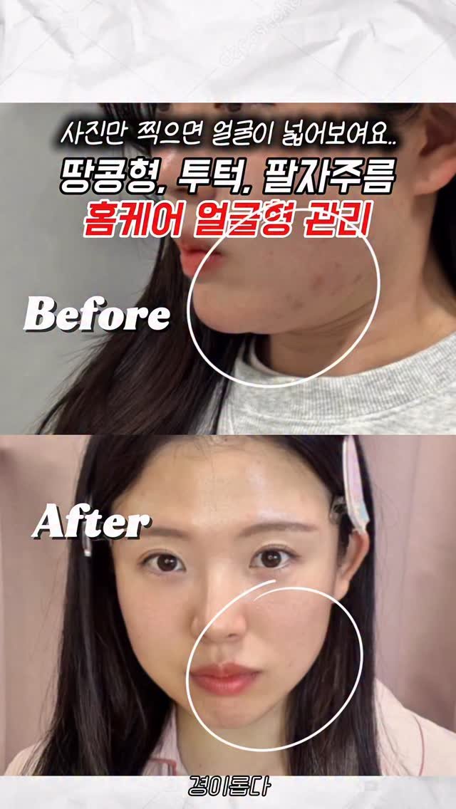 g.yeong__2 게시물 이미지: (저장)귀차니즘들 추천템.. ㄹㅇ 편해요✨

가만~히 차고만 있어도 
얼굴 라인 싹...