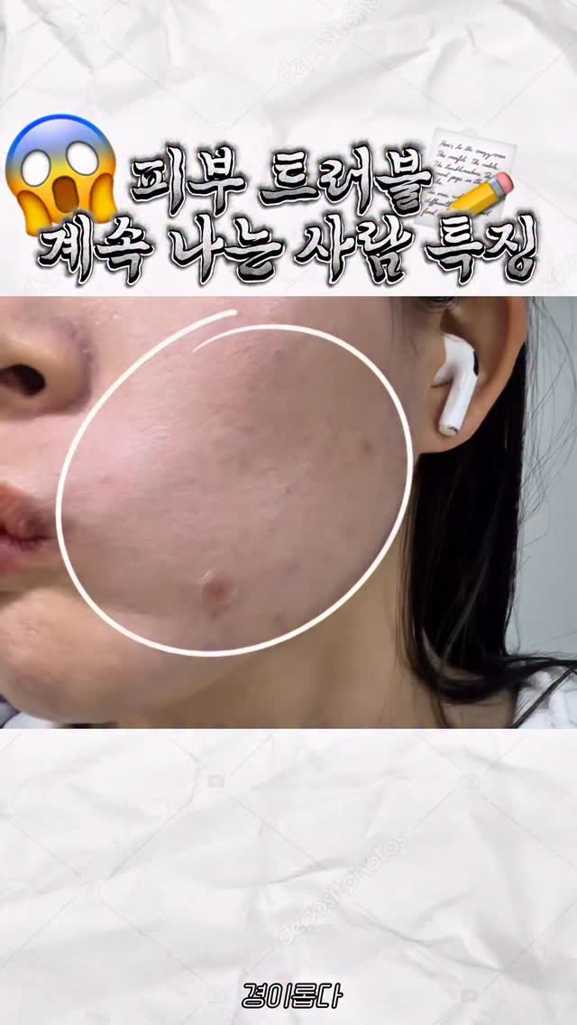 g.yeong__2 게시물 이미지: 광고❌ 0원으로 #트러블관리 이대로만🙏🏻

트러블 때문에 이것저것 다...