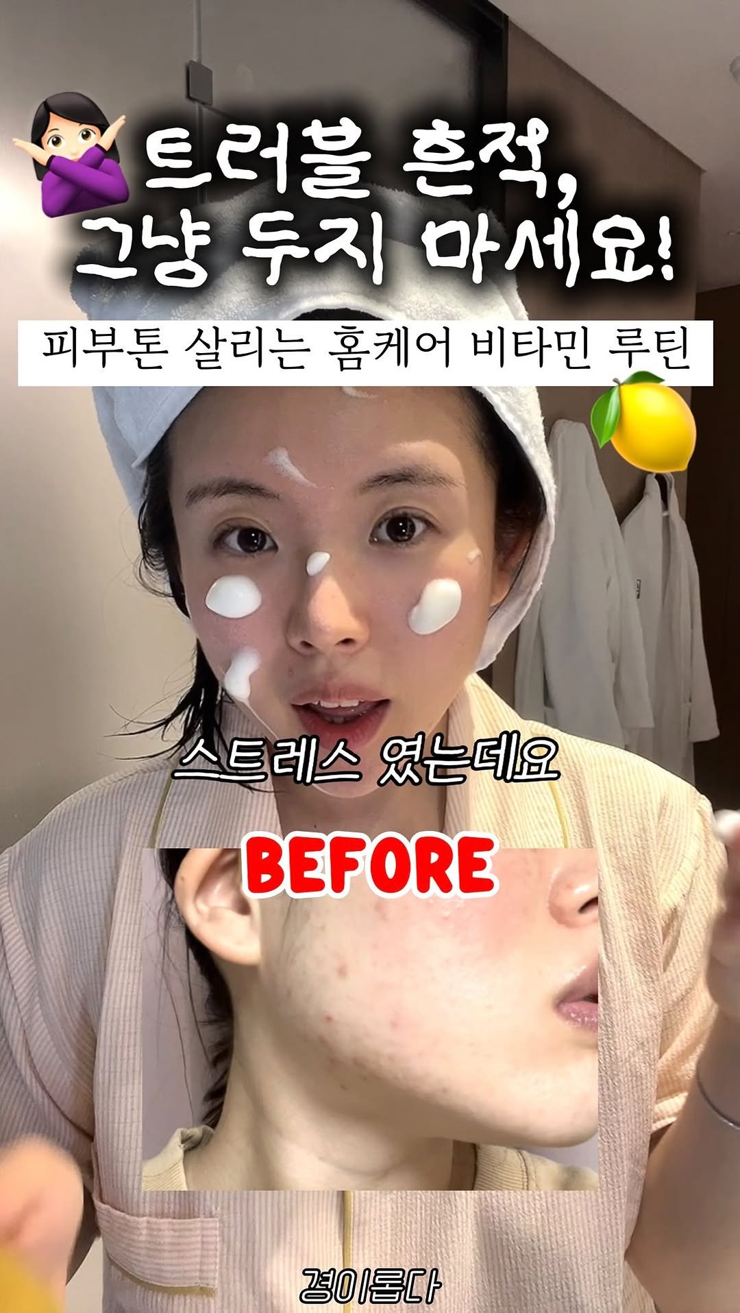 g.yeong__2 게시물 이미지: 나만 몰랐던 #청담샵추천템 ?!
🍋 통레몬수가 69%나 들어간 착즙세럼
거품처럼...
