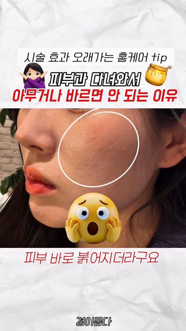 g.yeong__2 게시물 이미지: 댓글이벤트‼️시술받고 이거 모르면 진짜 후회해요

피부과 시술 후에는
피부가...