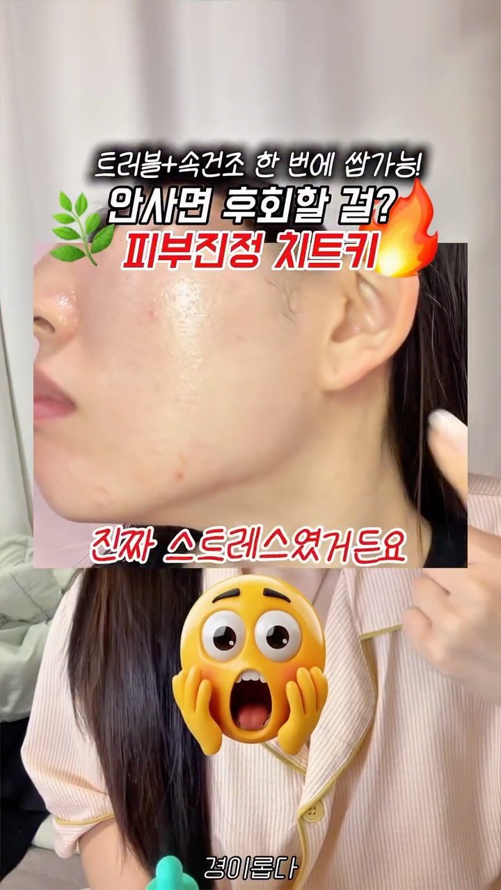 g.yeong__2 게시물 이미지: 이거 모르고 트러블 관리하면 손해, 당장 저장📌

요즘 피부가 뒤집어져서 진짜...