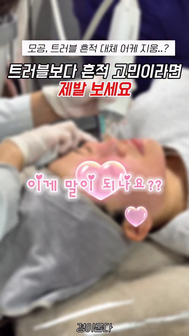 g.yeong__2 게시물 이미지: 와 이게 되네,, 

깐달걀피부 만들고싶은 사람 ~? 

어렸을 때부터 여드름이...