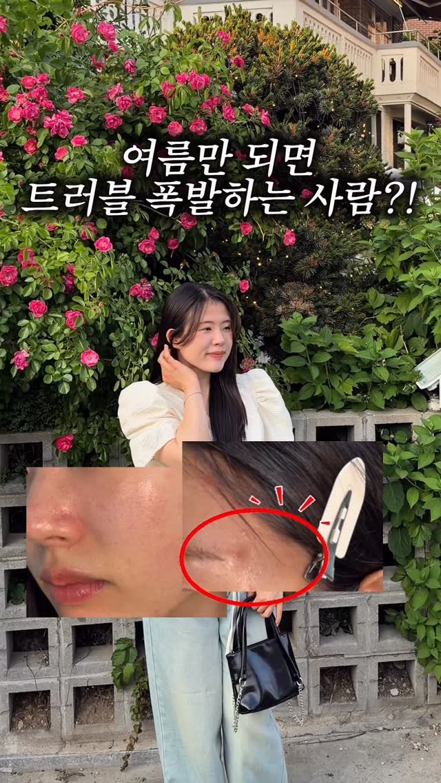 g.yeong__2 게시물 이미지: 댓글이벤트‼️ 여름만 되면 피부 열감 때문에 
붉은기 + 오돌토돌 트러블 올라오는...