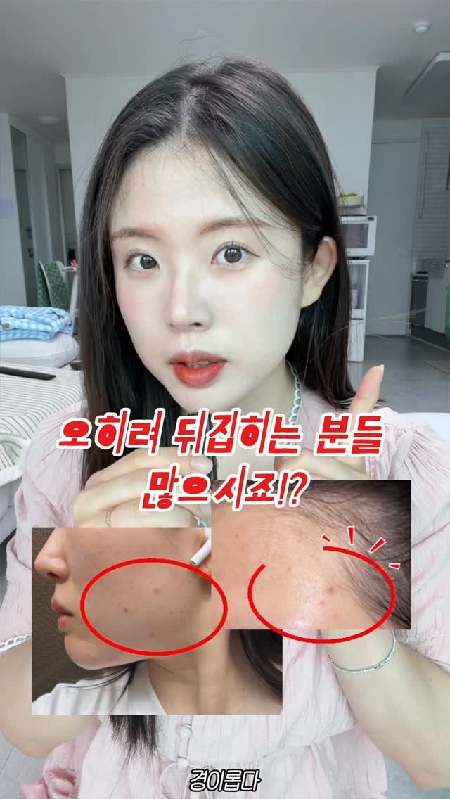 g.yeong__2 게시물 이미지: 댓글이벤트‼️ 관리받고 이거 안 하면 피부 뒤집혀요 ㄹㅇ..

시술 후엔
피부 속...