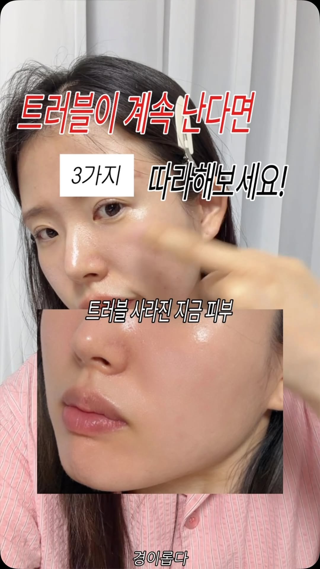 g.yeong__2 게시물 이미지: 피부 뒤집혔다면 제발 봐☠️… #광고

생각보다 많은 분들이 놓치는 게
#피부장벽...