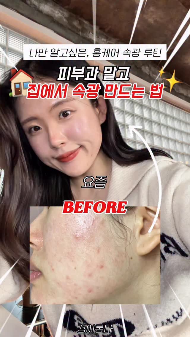 g.yeong__2 게시물 이미지: 댓글이벤트‼️올영에서 살 수 있는 속광 찐조합

바르자마자 촉촉한 광이...