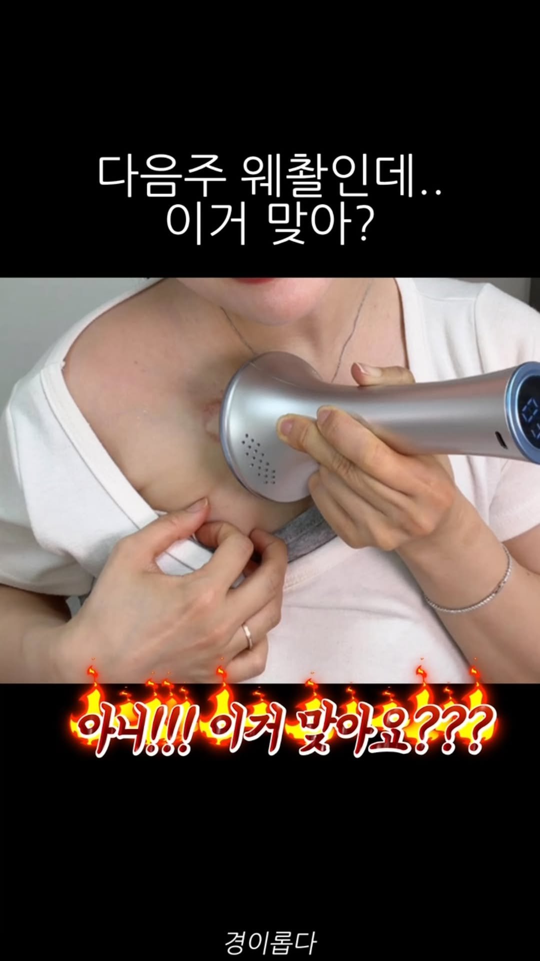 g.yeong__2 게시물 이미지: 나 드레스 입을 수 있을까....

쇄골, 승모, 팔뚝, 배, 종아리
이거 하나로...