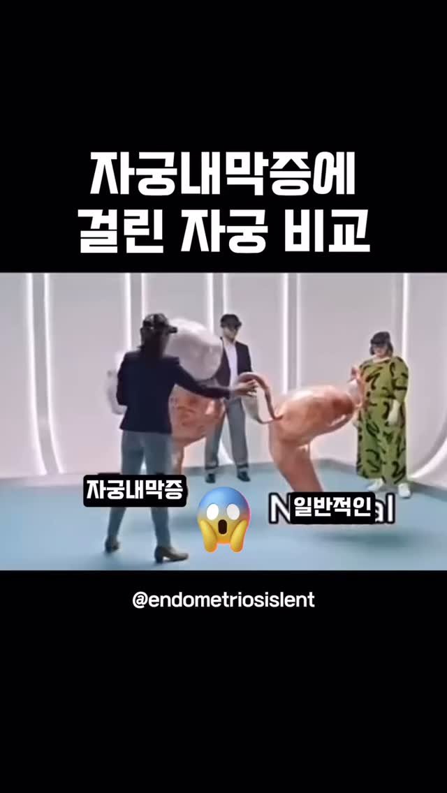 gaengstar1 게시물 이미지: “그냥 생리통인 줄 알았는데…”
그 통증, 자궁내막증일 수 있습니다.

✔ 생리통이...