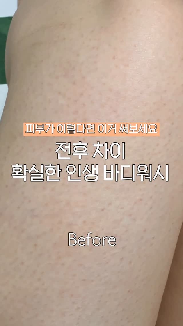 ggultem_jigi 게시물 이미지: 여름이 가면 피부가 이렇게 .. 
@todaywith.korea #광고...