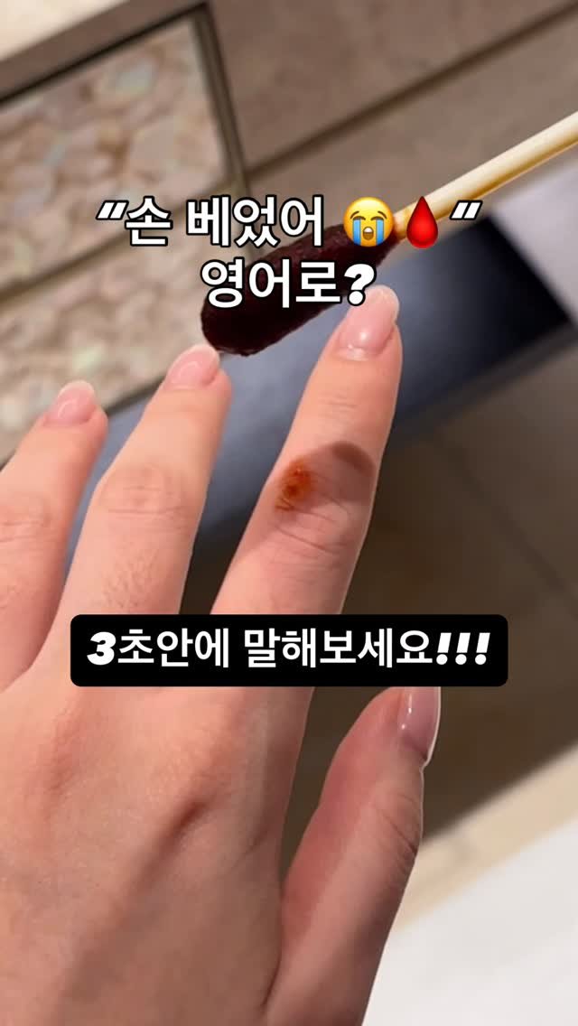 ginafficial 게시물 이미지: 날카로운 거에 손 베였을때…😨
영어로는 뭐라고 표현할까요? 

“Cut” 이 한...
