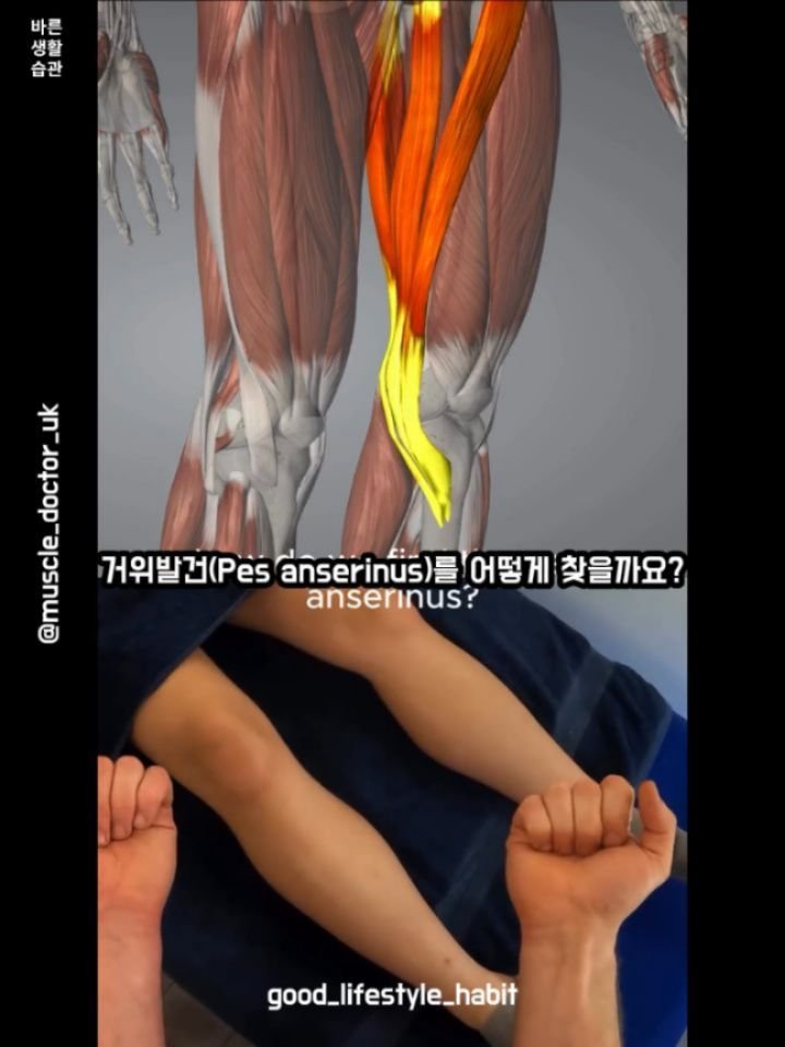 good_lifestyle_habit 게시물 이미지: 무릎 안쪽 통증에 있어서 중요한 Pes Anserinus(거위발건) 찾는 방법...