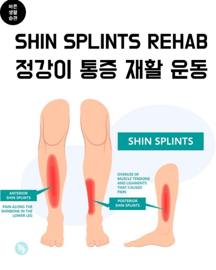 good_lifestyle_habit 게시물 이미지: 정강이 통증 재활

정강이 통증은 달리기, 점프, 또는 단순히 오래 서 있는 시간을...