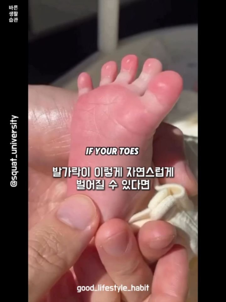 good_lifestyle_habit 게시물 이미지: 발가락을 자유롭게 벌릴 수 있나요?

힘들다면 영상 속 운동을 시작해...