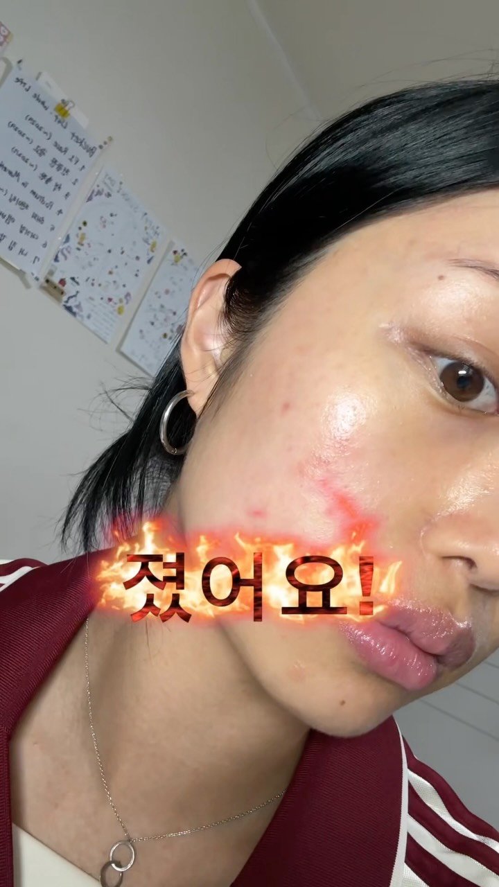 got_sunnyday 게시물 이미지: #AD 진짜 속상해…🫠

생전 이렇게 뒤집어진 적 없었는데 ㅠㅠ

그래도 아직...