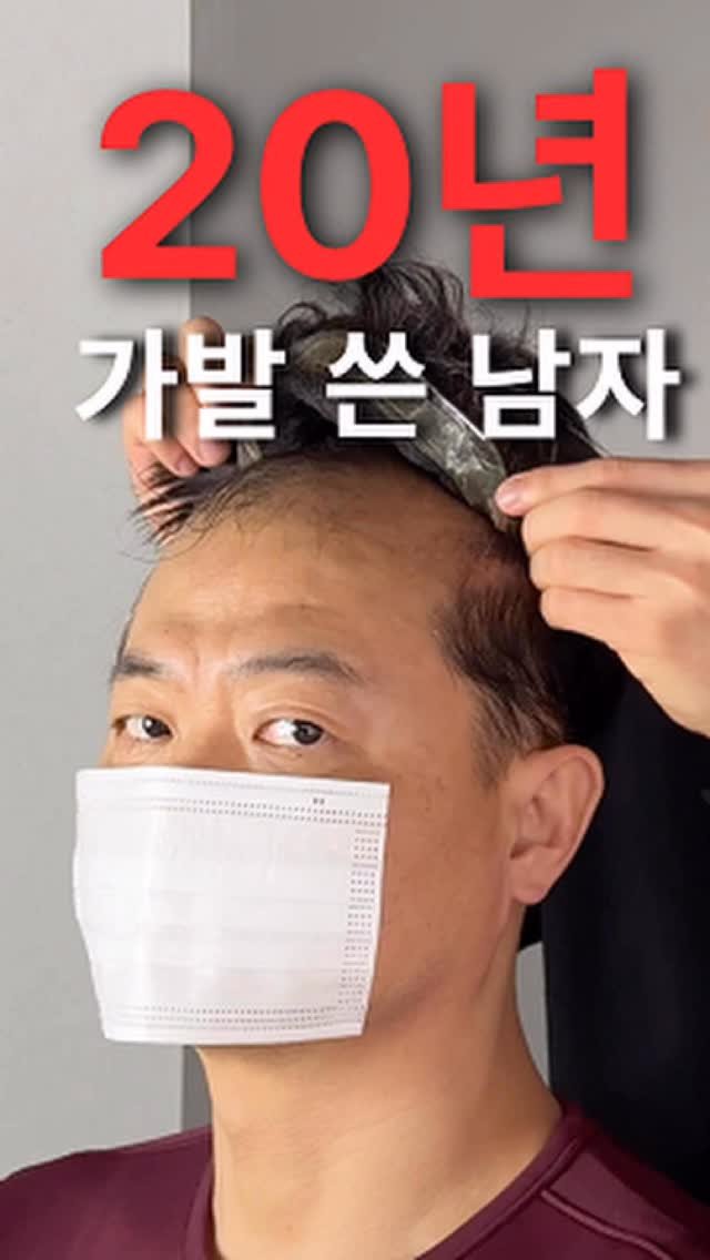 graycity_nix 게시물 이미지: 가발 안에서 20년 동안 숨 막히던 두피 상태, 상상이 가시나요?
.
.
.
오랜...
