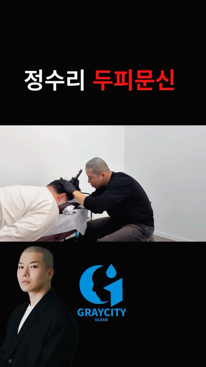 graycity_nix 게시물 이미지: 정수리 두피문신 시술 과정 

조용히 집중하며 진행하는 실제 시술 현장입니다....