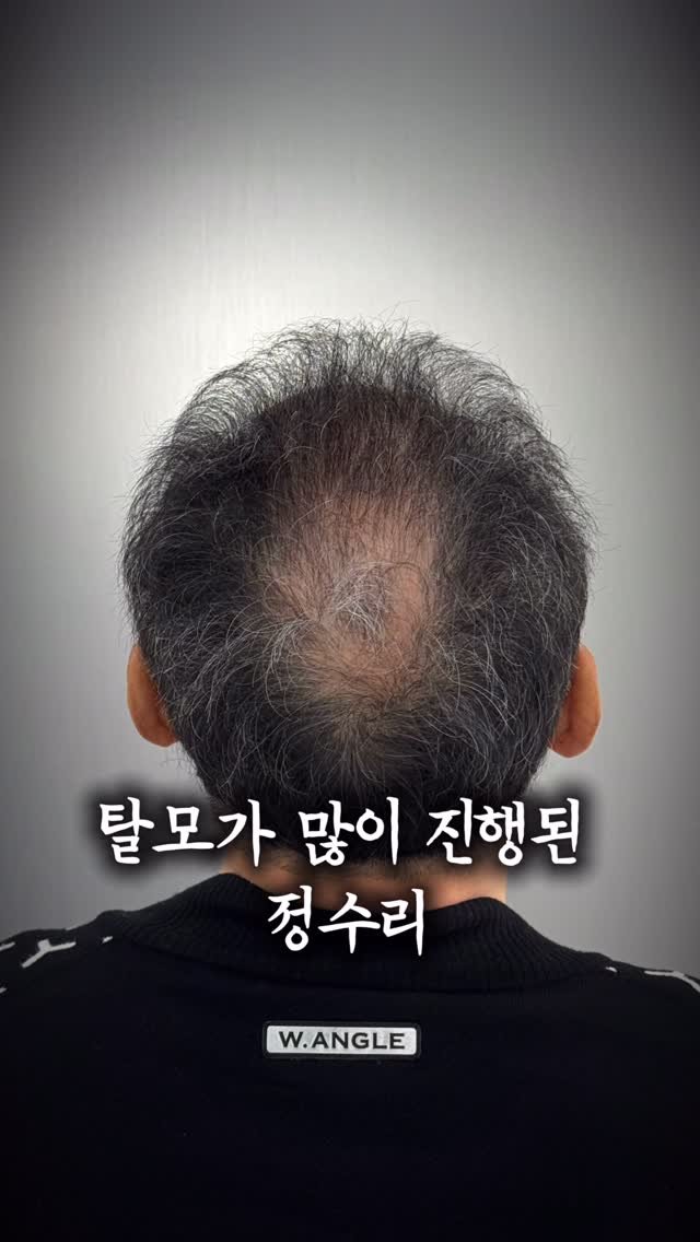 graycity_nix 게시물 이미지: ”60대 남자가 딱 10년 젊어지는 데 필요한 것?“ ⏱️
.
.
.
60대 중년...