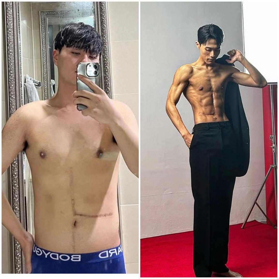 gymcity_mplee_ 게시물 이미지: 비포 애프터,후기,영상피드백,식단체크,회원님 환경 및 체질에 맞는 지속가능한...